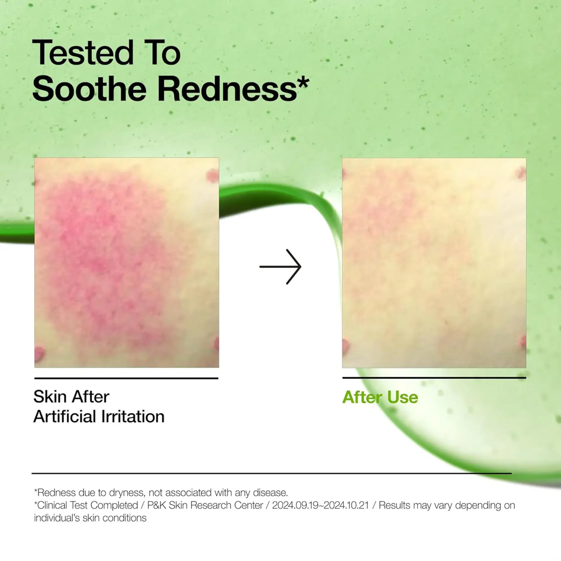 Azelaic Acid 10 Hyaluron Redness Soothing Serum — view 3 of 8